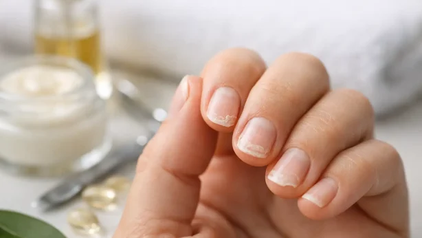 Nail Peeling Causes and What Your Nails Need